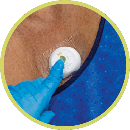 Wearable patient sensor